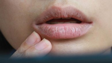 صورة هل يشير جفاف الفم لوجود مشاكل صحية خطيرة؟
