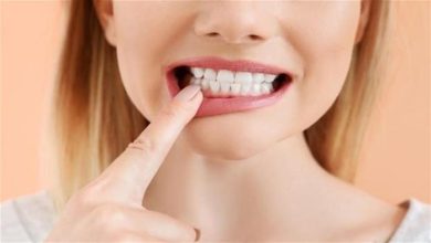 صورة ما أسباب حساسية الأسنان؟
