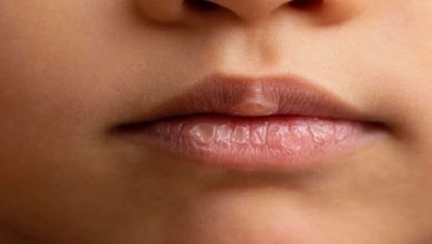 صورة جفاف الفم قد يكون علامة على الإصابة بخمسة أمراض خطيرة