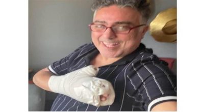 صورة إصابة المؤلف تامر حبيب بكسر في يده بعد سقوطه في الحمام (صورة)