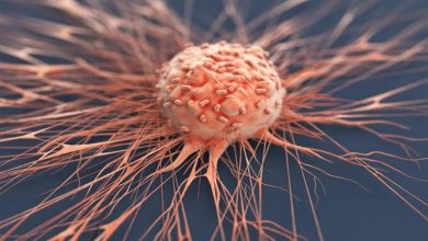 صورة مادة غذائية تمنع تطور الورم السرطاني.. ما هي؟