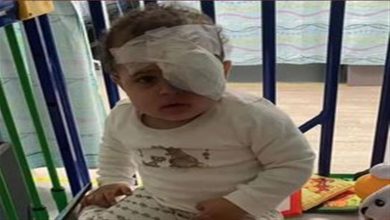صورة فتاة صغيرة تفقد إحدى عينيها بعد خطأ طبيب في “تشيشير”.. ماذا حدث؟