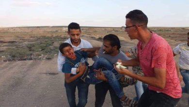 صورة إصابة طفل بحروق في هجوم للمستوطنين على مسافر يطا