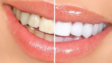 صورة 4 مكونات طبيعية لتبييض الأسنان- تعرف عليها