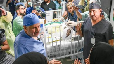 صورة نجاح فصل التوأم السيامي التنزاني «حسن وحسين» بعد عملية جراحية معقدة استغرقت 16 ساعة  أخبار السعودية