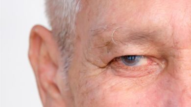 صورة الجلوكوما.. مرض صامت يهددك بالعمى
