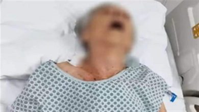 صورة بعد إعلان وفاتها.. مريضة على قيد الحياة في ثلاجة الموتى – قصة صادمة