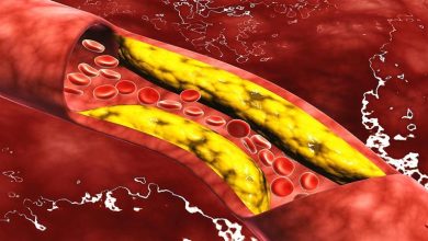 صورة 4 علامات تنذرك بارتفاع الكولسترول في الدم