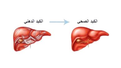 صورة أمريكا توافق على أول دواء لعلاج «الكبد الدهني»  أخبار السعودية