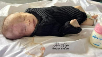 صورة ارتفاع عدد الأطفال ضحايا الجوع بمستشفى كمال عدوان إلى 15