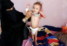 صورة ألفا يمني ماتوا بالملاريا خلال شهرين .. وأكثر من 82 ألف إصابة في 8 محافظات تسيطر عليها المليشيات