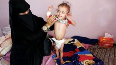 صورة ألفا يمني ماتوا بالملاريا خلال شهرين .. وأكثر من 82 ألف إصابة في 8 محافظات تسيطر عليها المليشيات