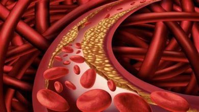 صورة كيف يؤثر ارتفاع الكوليسترول الضار على ضغط الدم؟