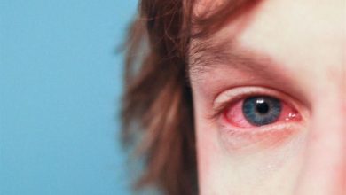 صورة أعراض تستوجب استشارة الطبيب فورا.. طبيبة عيون تكشف