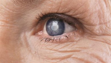 صورة مرض “المياه الزرقاء”.. هل يسبب العمى؟