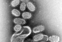 صورة الأنفلونزا.. العامل الأكثر خطورة وبائياً  أخبار السعودية