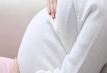 صورة 6 نصائح للتقليل من تصبغات الجلد في الحمل