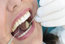 صورة مشكلات صحية في الأسنان تصيبك بأمراض خطيرة