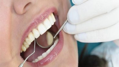 صورة مشكلات صحية في الأسنان تصيبك بأمراض خطيرة