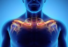 صورة متلازمة مخرج الصدر.. الأعراض والأسباب