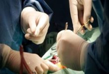 صورة «مصر» تنفي انتشار تجارة الأعضاء البشرية بين الأطباء  أخبار السعودية
