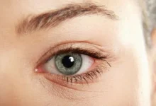 صورة أعراض مهمة تدل على أمراض العين